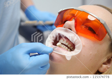 classical dental coloring for determining color of teeth Banner tooth whitening, teeth close up with shade guide bleach color, female veneer smile, dental care and stomatology, dentistry, copyspace. 115374778