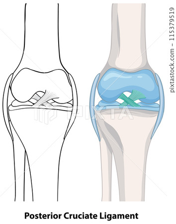 Posterior Cruciate Ligament Anatomy Posterior Cruciate Ligament Anatomy 115379519