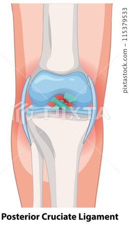 Posterior Cruciate Ligament Anatomy Posterior Cruciate Ligament Anatomy 115379533