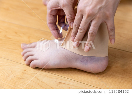 一位女士正在對扭傷的腳踝進行敷料 115384162