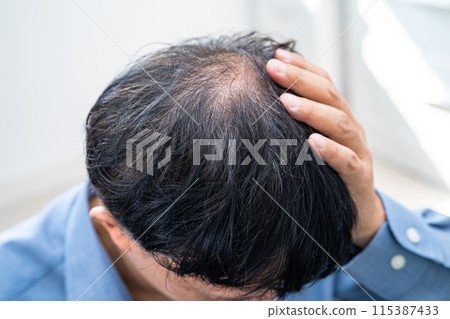 Bald in the middle head and begin no loss hair glabrous of mature Asian business smart active office man. 115387433