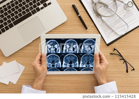 medical healthcare brain 115415428