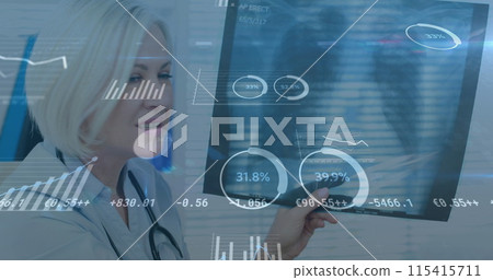 Image of data processing and statistics over female doctor and patient looking at x ray scan Image of data processing and statistics over female doctor and patient looking at x ray scan 115415711