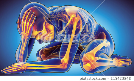 頭痛的視覺表現:體現腰部疼痛與不適的圖像。 頭痛的視覺表現:體現腰部疼痛與不適的圖像。 115423848