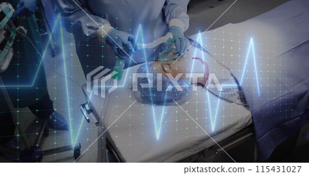 Image of cardiograph over diverse surgeons operating on patient at hospital 115431027