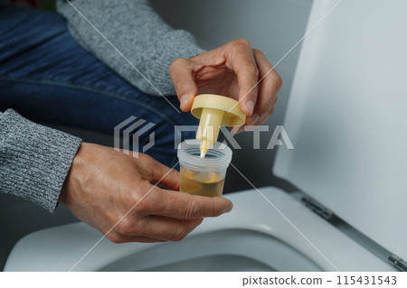 man collecting a urine sample in the bathroom man collecting a urine sample in the bathroom 115431543