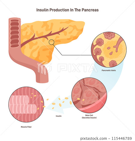 Insulin production mechanism. Pancreas b-cells release insulin. Metabolic actions of insulin in striated muscle. Flat vector illustration 115446789