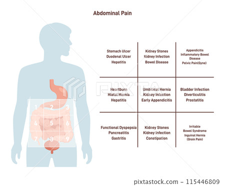 Abdominal ache map. Medical infographic or self-help guide. Spasm and burning in belly area. Stomachache location. Flat vector illustration Abdominal ache map. Medical infographic or self-help guide. Spasm and burning in belly area. Stomachache location. Flat vector illustration 115446809