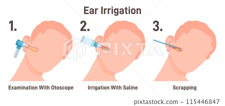 ENT doctor irrigate ears. Doctor checking ear canals, removing earwax with saline solution. Patient at medical checkup at otolaryngologist appointment. Flat vector illustration 115446847