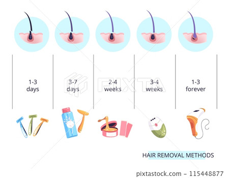 Hair removal methods. Body depilation hairs remove method epilation tool infographic, sugaring laser shave wax beauty salon poster skin 115448877