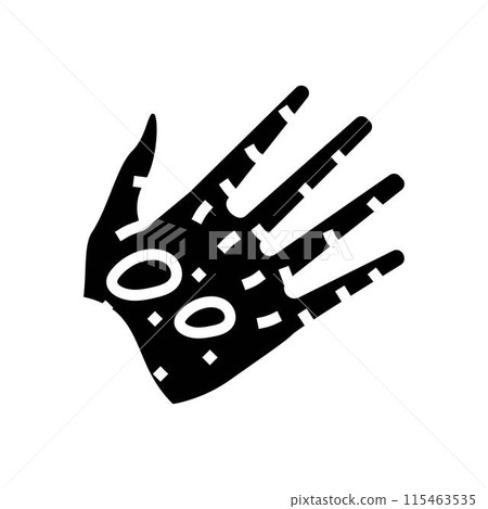 epidermolysis bullosa disease glyph icon vector illustration 115463535