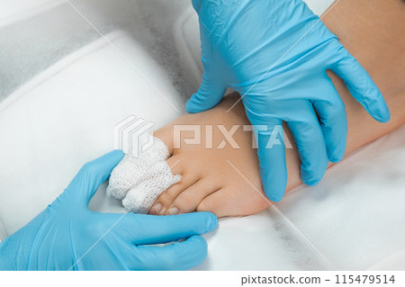 Close up bandaged toes of a patient after podiatrist treatment. Close up bandaged toes of a patient after podiatrist treatment. 115479514