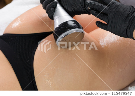 Undergoing ultrasound cavitation, a young woman seeks body contouring. Undergoing ultrasound cavitation, a young woman seeks body contouring. 115479547