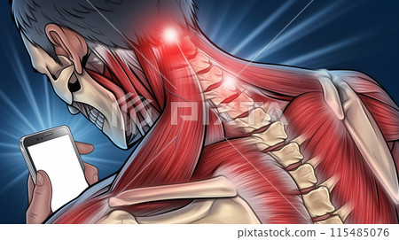 "Visual representation of neck muscle fatigue caused by prolonged smartphone use." <AI-generated material> 115485076