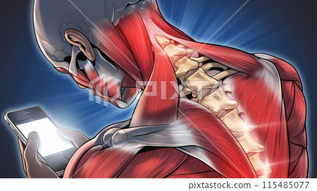 「長期使用智慧型手機而導致的頸部肌肉疲勞的視覺表現。」<AI生成的材料> 115485077