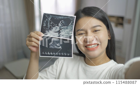 A portrait of happy Asian pregnant woman in bedroom at home with baby ultrasound. Having a baby. Family people lifestyle. Mom love. A portrait of happy Asian pregnant woman in bedroom at home with baby ultrasound. Having a baby. Family people lifestyle. Mom love. 115488087