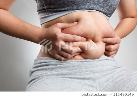 Woman grabbing belly fat 115490149