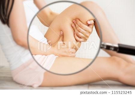 A magnifying glass is used to magnify cellulite on a woman's thighs. 115523245