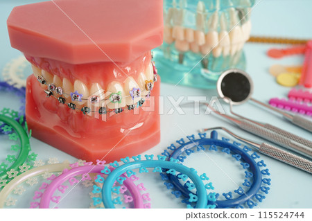 Orthodontic ligatures rings and ties, elastic rubber bands on orthodontic braces, model for dentist studying about dentistry. 115524744