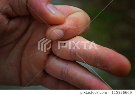 An infected insect tick crawls on the skin of a person's hand. 115526669