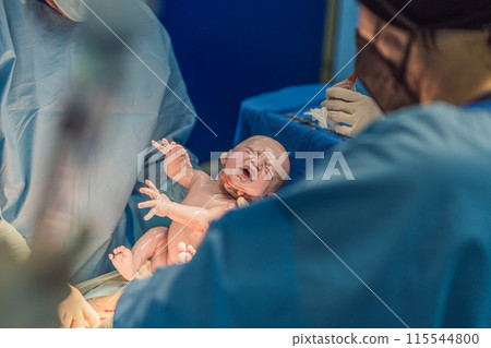 A baby is delivered during a caesarean section. The surgical procedure is conducted in a sterile operating room with a skilled medical team, ensuring the safety and health of both mother and baby A baby is delivered during a caesarean section. The surgical procedure is conducted in a sterile operating room with a skilled medical team, ensuring the safety and health of both mother and baby 115544800