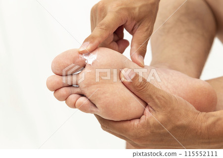 Hands applying medicine to feet on white background 115552111
