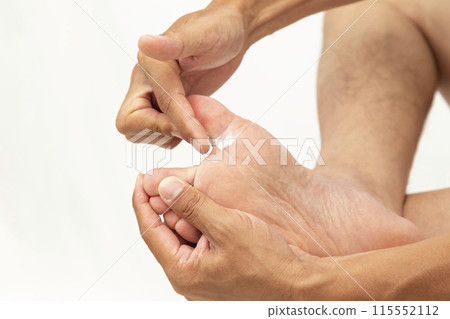 Hands applying medicine to feet on white background Hands applying medicine to feet on white background 115552112