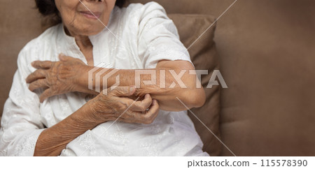 Elderly woman itchy and scratching arm because dry skin. 115578390