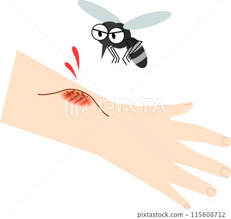 手被蚊子咬了 115608712