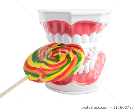 Tooth decay model with colorful candy sweet food on white background with copy space. Tooth decay model with colorful candy sweet food on white background with copy space. 115608753