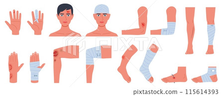 Bandaged body parts. Open wounds, different injuries, abrasions and bruises, arms, head and legs, medical allowance, traumatology and rehabilitation, cartoon flat isolated nowaday vector set 115614393