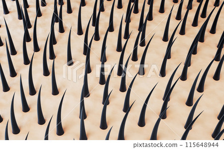 fiber, stem, epidermis 115648944