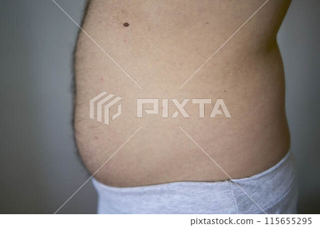 the side and stomach of a thirty-year-old man of average build 115655295