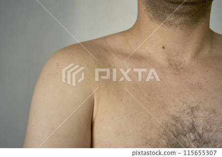 shoulder of a thirty-year-old man of medium build 115655307