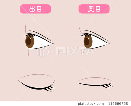 後眼瞼突出、眼部美容 115666768
