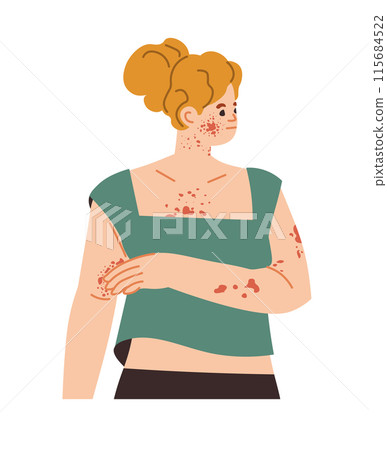 Woman with Rash on Arm vector Woman with Rash on Arm vector 115684522