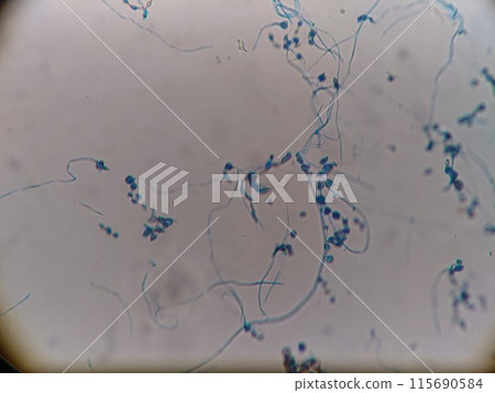 從冰箱上的橡膠貼片中分離出黴菌 從冰箱上的橡膠貼片中分離出黴菌 115690584