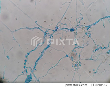 Microscopic image of mold growing in a refrigerator 115690587