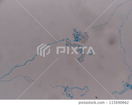 Mold spores visible through staining methods 115690662