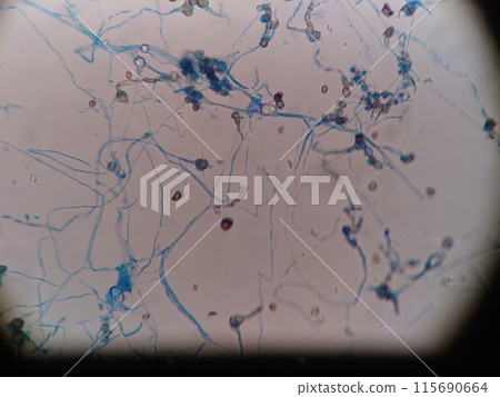 Mold spores and hyphae growing in a refrigerator 115690664
