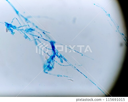 Mold mycelium stained with cotton blue 115691015