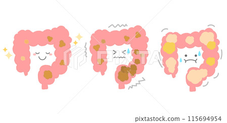 Healthy intestines and intestines with constipation and gas - Hand-drawn characters Healthy intestines and intestines with constipation and gas - Hand-drawn characters 115694954