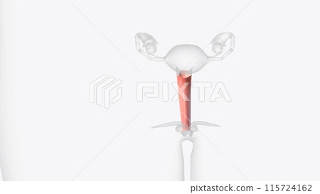 The vagina is a closed muscular canal that extends from the outside of the female genital area 115724162
