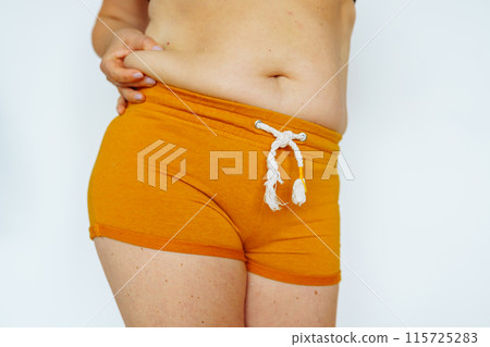 unrecognizable woman showing fat belly with saggy skin 115725283