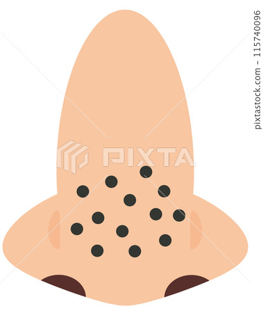 鼻子腫塊 115740096