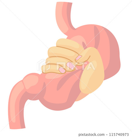 被抓住的胃 115740973