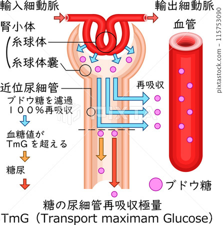 Renal corpuscle diabetes illustration Japanese 115753090