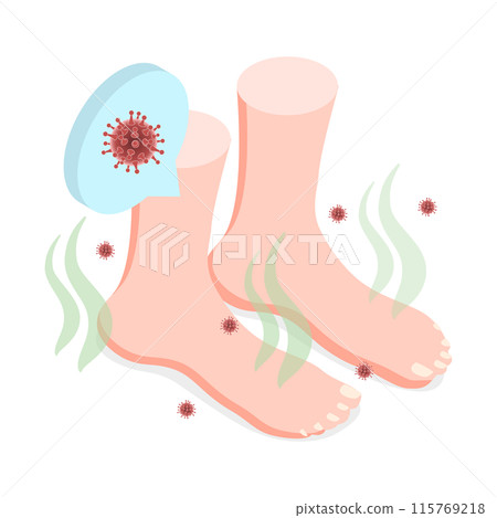 3D Isometric Flat  Illustration of Feet Unpleasant Smell, Fungal Lesions 115769218