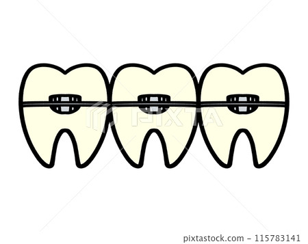 Orthodontics, illustration material of teeth undergoing correction 115783141