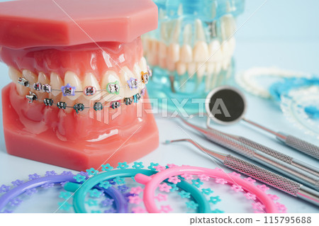 Orthodontic ligatures rings and ties, elastic rubber bands on orthodontic braces, model for dentist studying about dentistry. 115795688